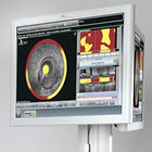 Infraredx TVC Imaging System